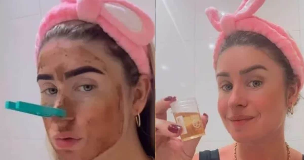 Woman applies ‘disgusting’ thing on face, gives such recipe for glowing skin, people start vomiting as soon as they hear!